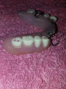 Luke's denture 1